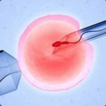 Ideal Fertility-ICSI