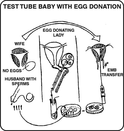 Egg Donation