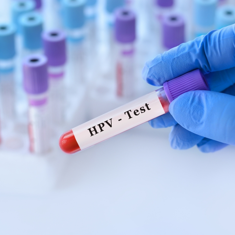 HPV-16 and HPV-18 in Molecular Diagnostics